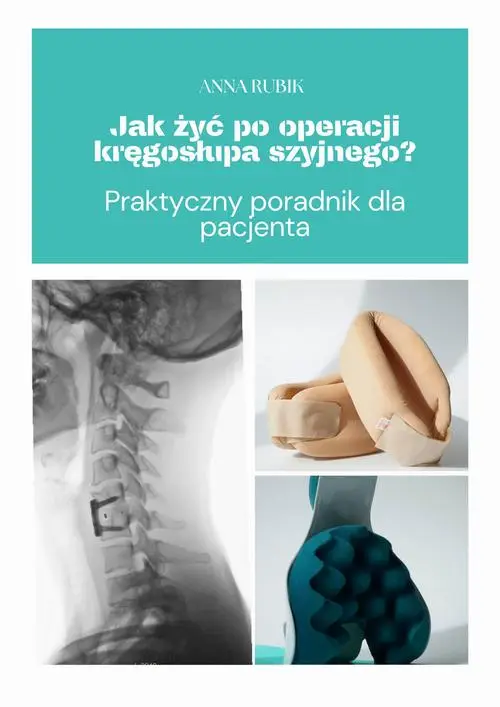 eBook Jak żyć po operacji kręgosłupa szyjnego? Praktyczny poradnik dla pacjenta - Anna Rubik epub mobi