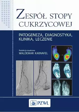 eBook Zespół stopy cukrzycowej - Waldemar Karnafel epub mobi