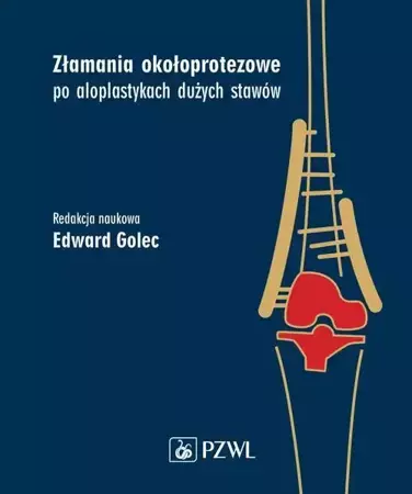 eBook Złamania okołoprotezowe po aloplastykach dużych stawów - Edward Golec mobi epub