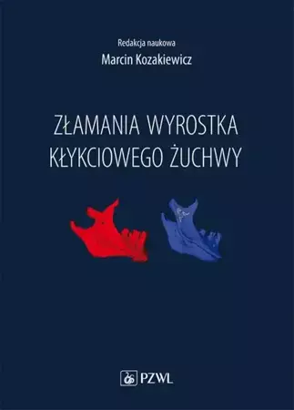 eBook Złamania wyrostka kłykciowego żuchwy - Marcin Kozakiewicz epub mobi